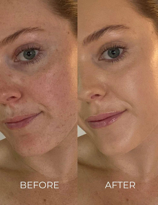 INIKA - Serum foundation - 11hektar
