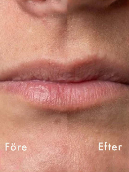 Trew - Peel Lip - AHA/BHA Exfolierande Läppvård